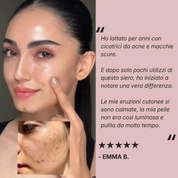 Evapura | Siero con Collagene e Peptidi di Seta